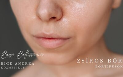 Bőrtípusok – iránymutatás a krémek világában – Zsíros bőr