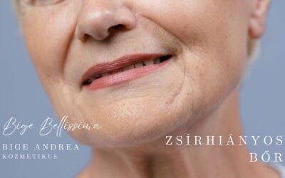Bőrtípusok – iránymutatás a krémek világában – Zsírhiányos bőr