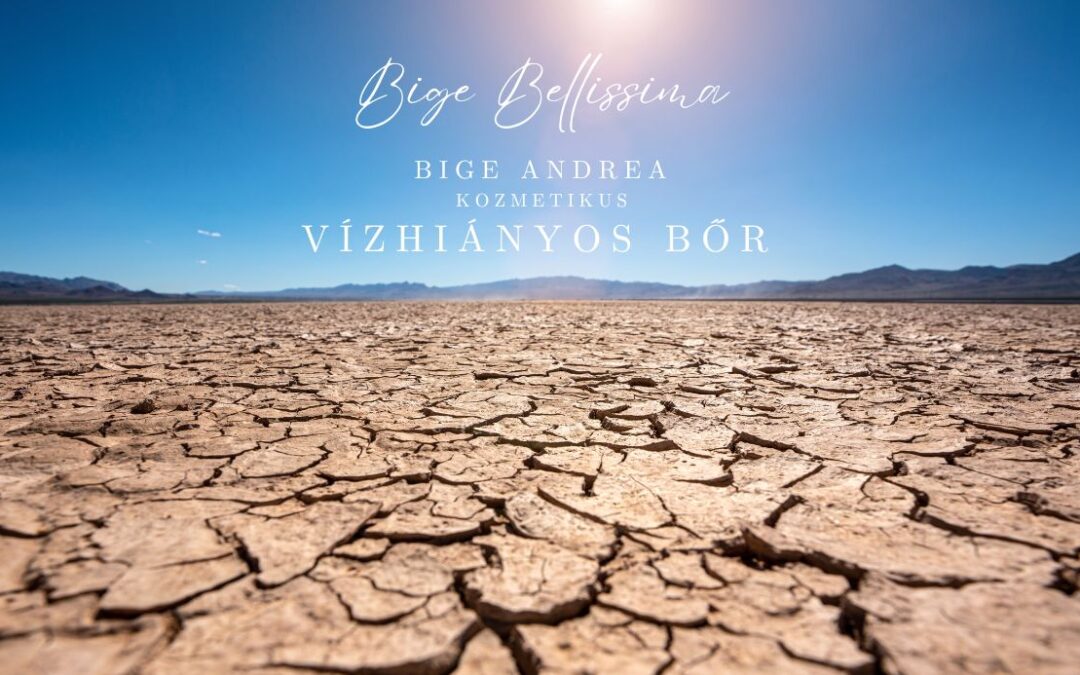 Bőrtípusok – iránymutatás a krémek világában – Vízhiányos bőr